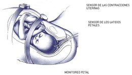 Monitorización fetal antes del parto: en qué consiste